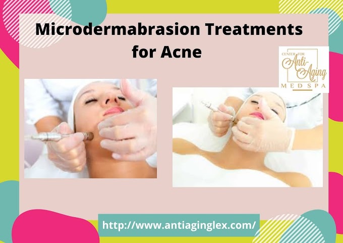 How Does Microdermabrasion Treatments Help Alleviate Your Skin