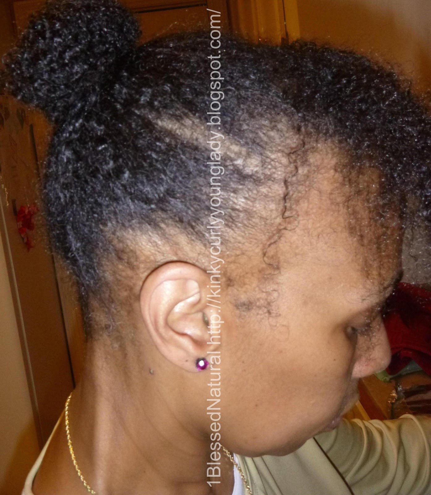 Micro Goddess Braids Hairstyles On Natural Hair  of hair due to from prolonged pulling on the hair usually associated