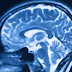 Caudate Nucleus Function, Location, Right and Left Caudate Nucleus