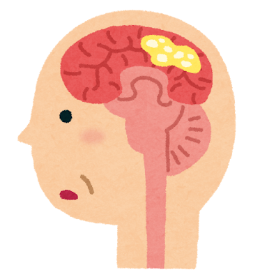 薬物依存症 そのメカニズムや身体 精神への影響について考える シングル ワーキングママのぽんちゃん日記