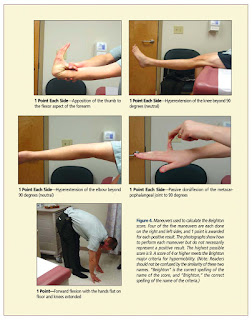   marfan syndrome คือ, marfan syndrome วินิจฉัย, marfan syndrome คือ pdf, marfan syndrome icd 10, โรคทางพันธุกรรม มาร์แฟน, marfan syndrome pantip, โรคมาร์แฟน pantip, marfan syndrome ตรวจร่างกาย, มาร์แฟนซินโดรม pantip