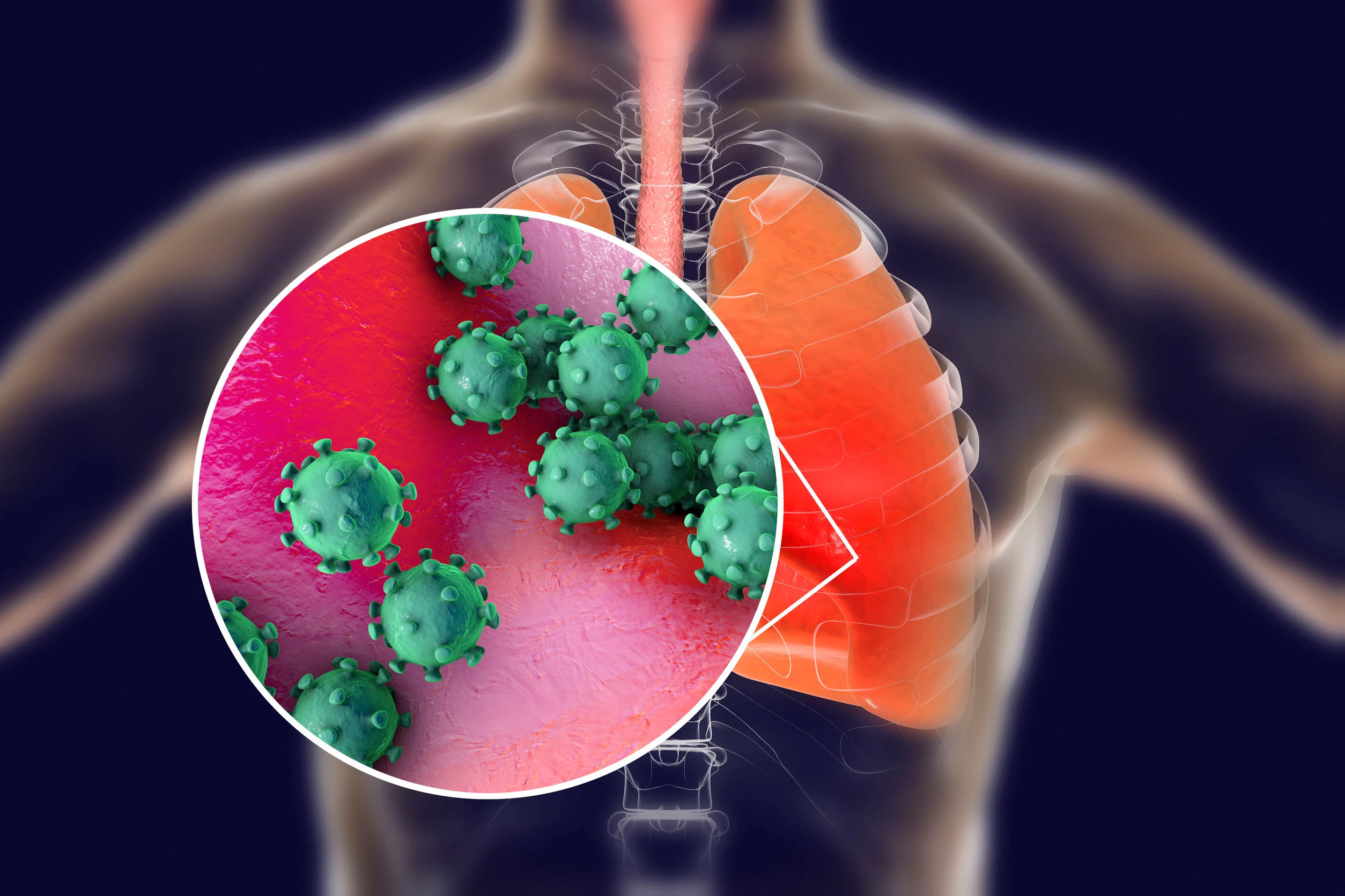 bird flu,symptoms of bird flu,bird flu infection,bird flu deaths,bird flu threat,bird flu vaccine for humans,bird flu cases,bird flu pandemic,h5n1,h5n1 virus,h5n1 symptoms