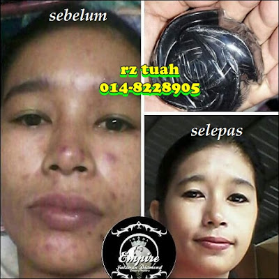 testimoni sabun qm queen black charcoal