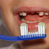 Toothbrush For Missing Front Teeth 