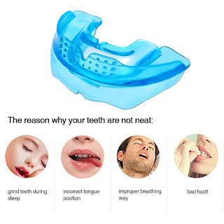 orthodontic trainer - penyebab