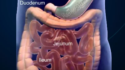 Pembahasan IPA SMP UN 2017 No. 31 - 35, sistem pencernaan pada manusia, organ pencernaan, usus halus, duodenum, jejenum, ilenum