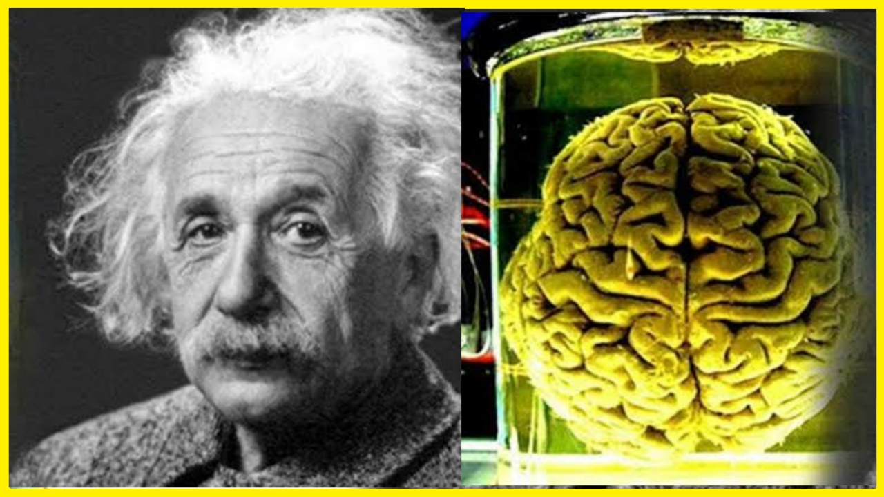 Who Stole Albert Einstein S Brain After Death