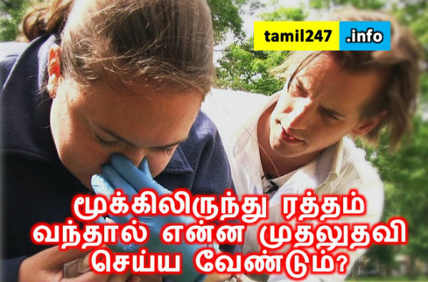 மூக்கிலிருந்து ரத்தம் வந்தால் என்ன முதலுதவி செய்ய வேண்டும்? 