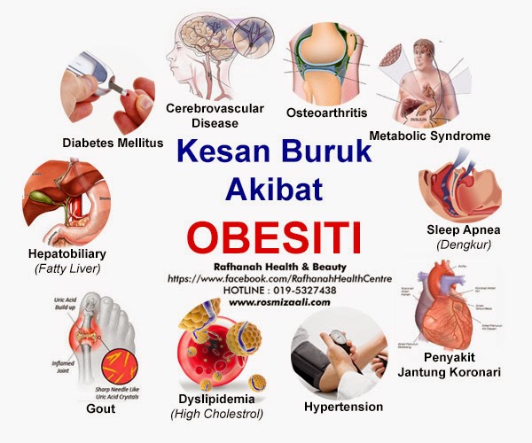 Nurin's Healthy Living: Fakta tentang Obesiti yang Anda 