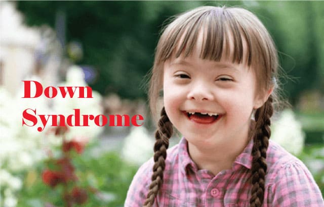 Down Syndrome: Types, Causes, and Symptoms