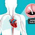 فهم مرض صمام القلب: أسبابه، درجة خطورته، أعراضه، وكيفية الكشف عنه