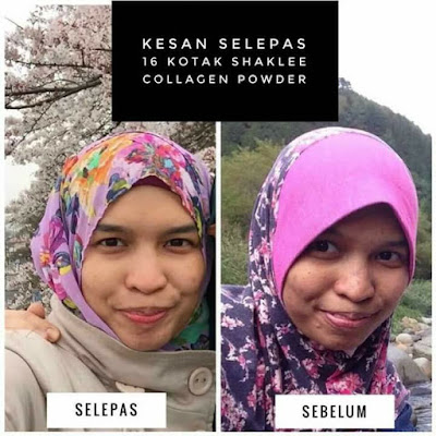 Testimoni Kulit Berseri Dan Anjal Dengan Produk Shaklee