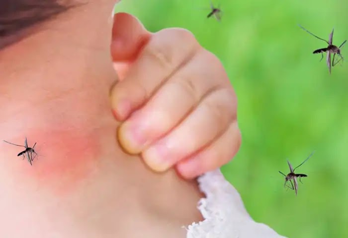 World Mosquito Day, Mosquitoes Bite, Health Tips, Health, Health News, Reasons Mosquitoes Bite Some People More Than Others.