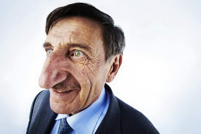 Mehmet Ozyurek Pemilik Hidung terbesar di dunia