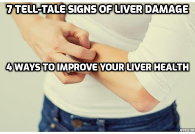 Have you been experiencing strange symptoms like itchy skin, lots of bruises, or water retention, and can’t put your finger on the cause? It could be a signs of liver damage. Here are the 7 tell-tale signs of liver damage and 4 ways to improve your liver health.