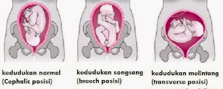 Kedudukan Baby Melintang