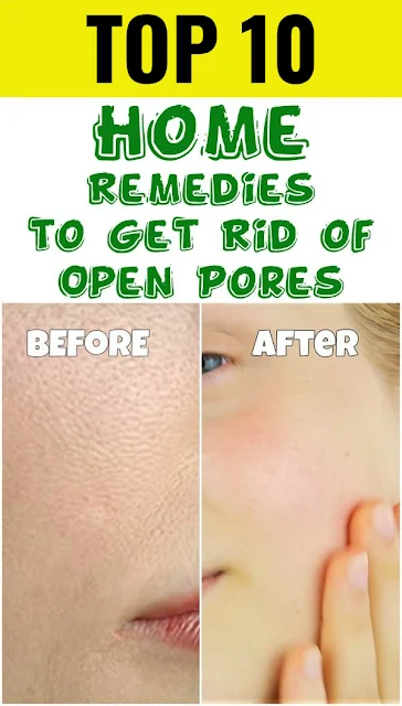10 Effective Natural Methods for Clearing Skin Pores