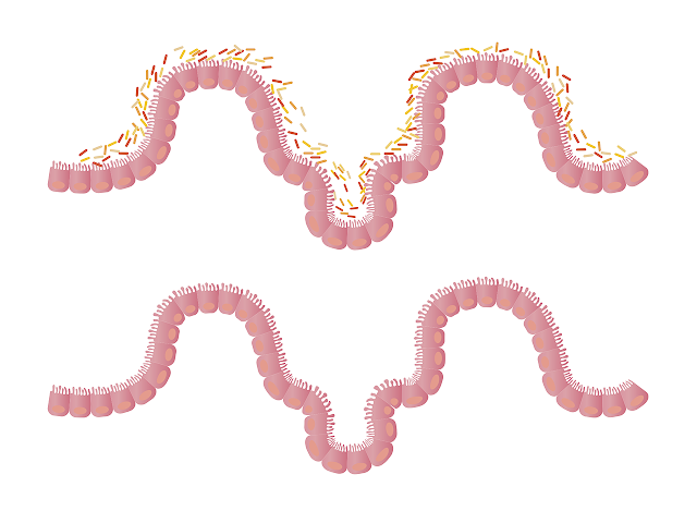 Probioticos y prebioticos