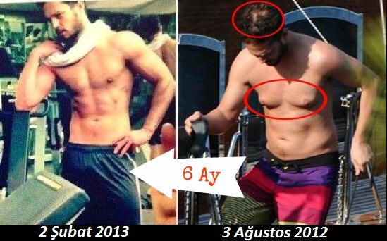 murat boz before after