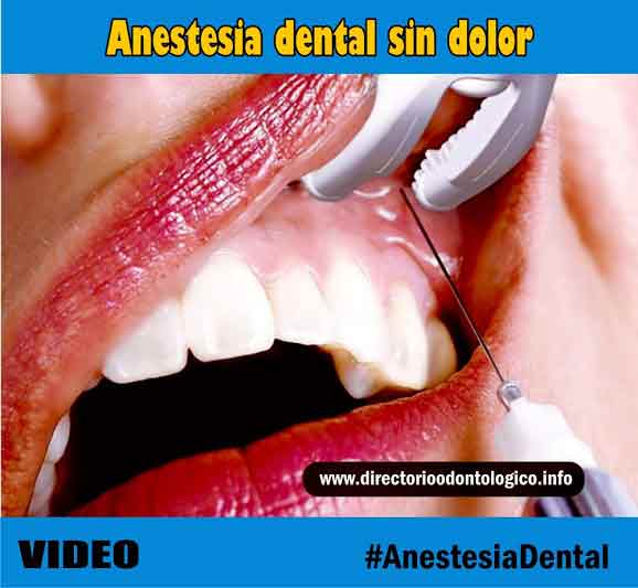 Anestesia Dental Sin Dolor