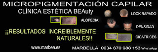 Micropigmentación capilar Córdoba Los mejores servicio para Micropigmentación capilar Córdoba tatuaje capilar Córdoba. pigmentacion capilar Córdoba, alopecia tratamiento Córdoba,