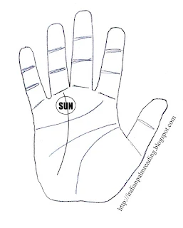 All Diseases Related To Mount Of Sun On Hand | Palmistry