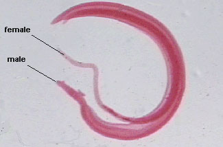 Schistosomiasis Infeksi karena Cacing Pita Terapi Sehat 
