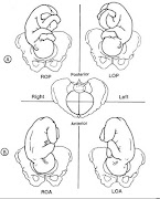 and suggest trying to avoid this during late pregnancy, if possible. (fetalpositions)