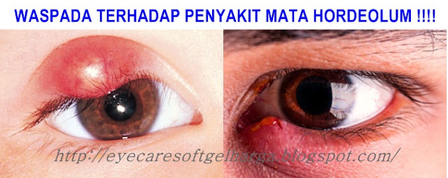 http://eyecaresoftgelharga.blogspot.com/