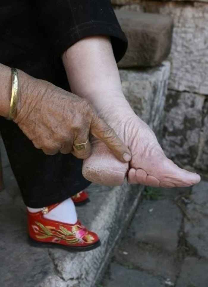 pé de chinesa pés de lótus