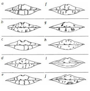 quieloscopia identificación huellas de labios