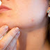 What are the home remedies tips to get rid of pimples? 