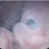 Vídeo de um feto de 10 semanas dentro do útero viraliza