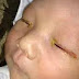 You Won't Believe This Baby Got BLIND - Don't Let This Happen To Your Child! (PLEASE READ & SHARE FOR OUR CHILD)..