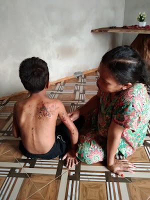 Sadis! Kesal dengan Istri, Bapak Bakar Anak Kandung di Kecamatan Parittiga 