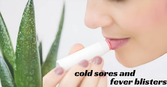 at home remedies for cold sores and fever blisters