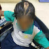 Budak 12 tahun cedera didera ibu saudara kerana tak basuh pinggan
