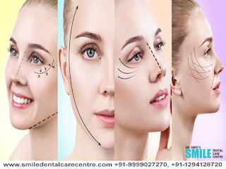 Best Face Surgeon in Faridabad