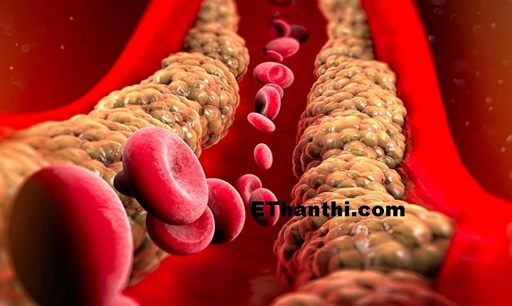 ட்ரைகிளிசரைட் (Triglycerides) என்றால் என்ன?