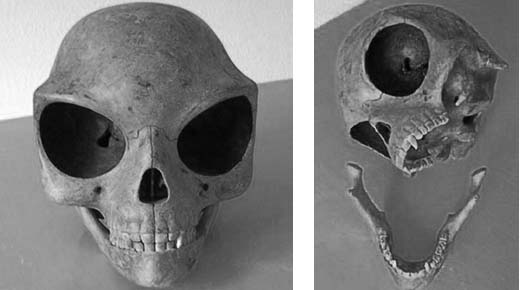 El polémico Cráneo de Sealand todavía plantea muchos interrogantes. ¿Será de origen extraterrestre?
