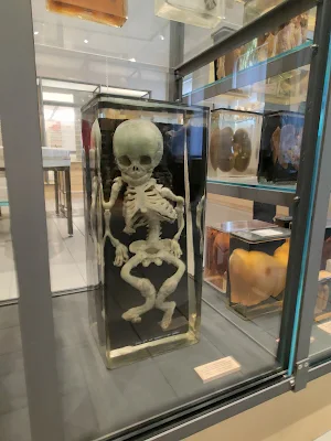 Det indsamlede menneskeの幼児の骨格展示