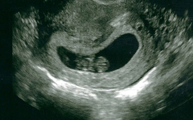 12 5 week ultrasound. Our 8 week ultrasound :-)