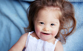 Jolina, 2 Jahre, Down Syndrom