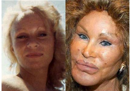 Photo Jocelyn Wildenstein Operasi Plastik