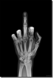 Xray