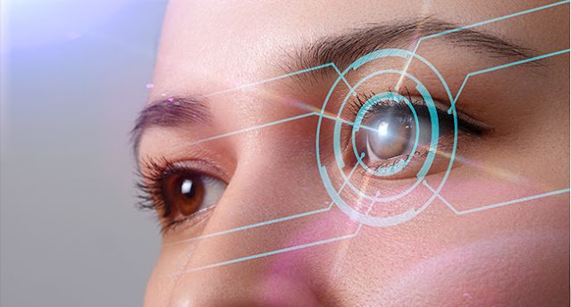 refractive surgery