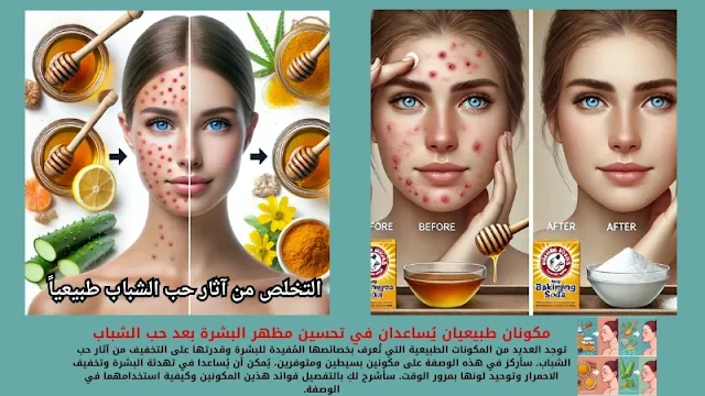 وصفة طبيعية للبشرة