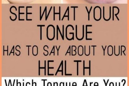 What Your Tongue Is Trying To Tell You About Your Health