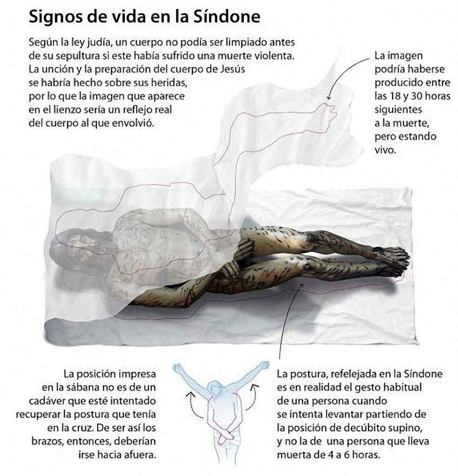 Sinais de vida no Sudário segundo o Dr. Bernardo Hontanilla.