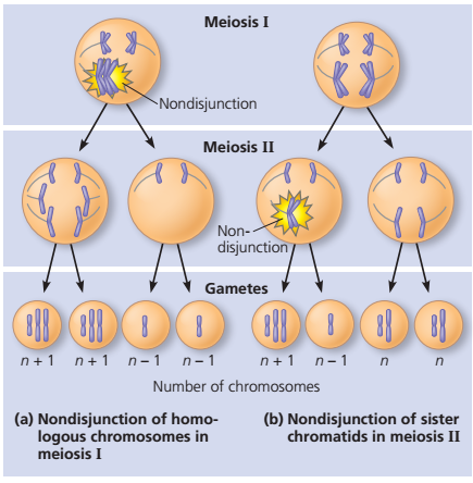 Aneuploidy monosomi dan trisomi serta Penyakit yang 